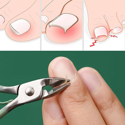 ProCare™ | De complete oplossing voor professionele nagelverzorging.