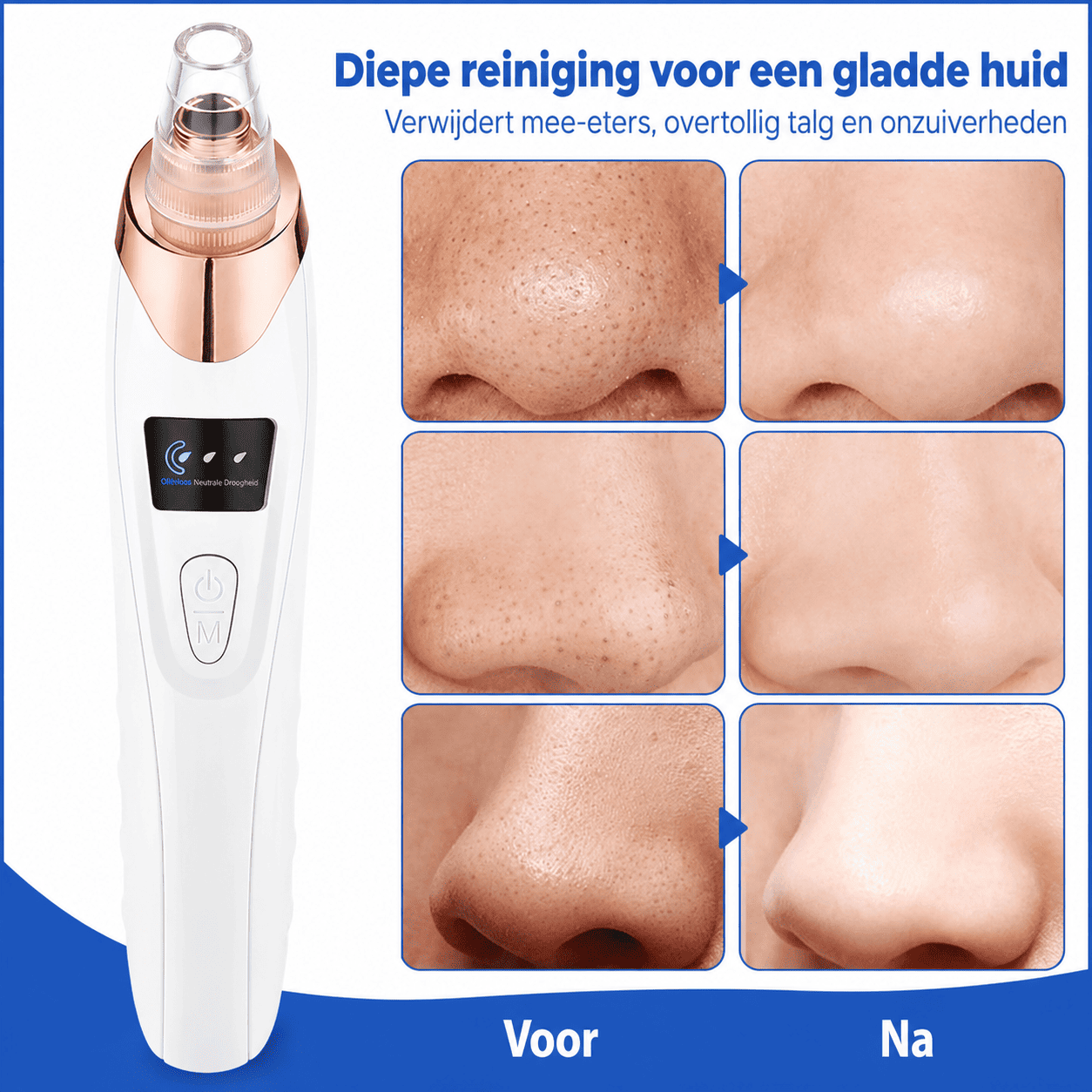 ClearPore™ | Voor een Gladdere, Schonere en Verzorgde Uitstraling.