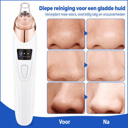 ClearPore™ | Voor een Gladdere, Schonere en Verzorgde Uitstraling.
