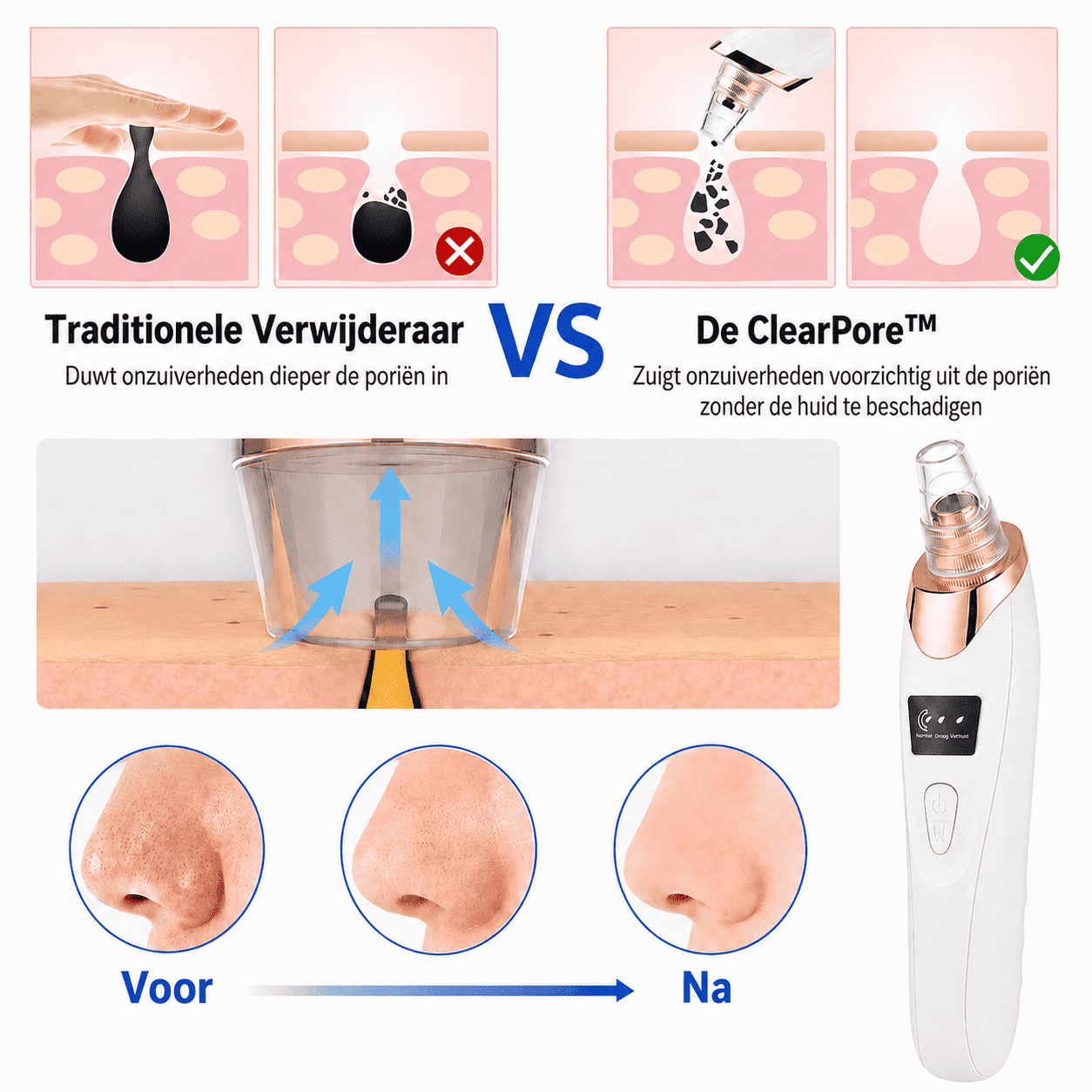 ClearPore™ | Voor een Gladdere, Schonere en Verzorgde Uitstraling.