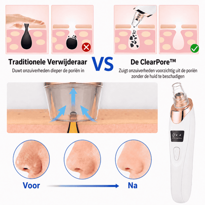 ClearPore™ | Voor een Gladdere, Schonere en Verzorgde Uitstraling.