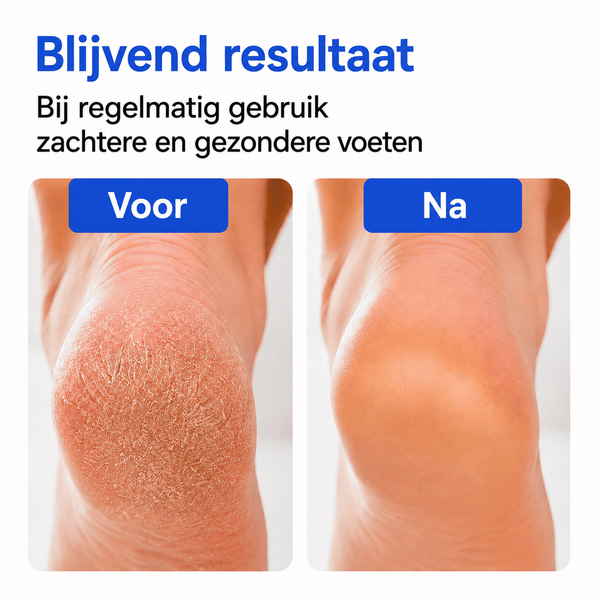 CleanStep™ | Reinigt Waar Je Handen Moeilijk Komen.