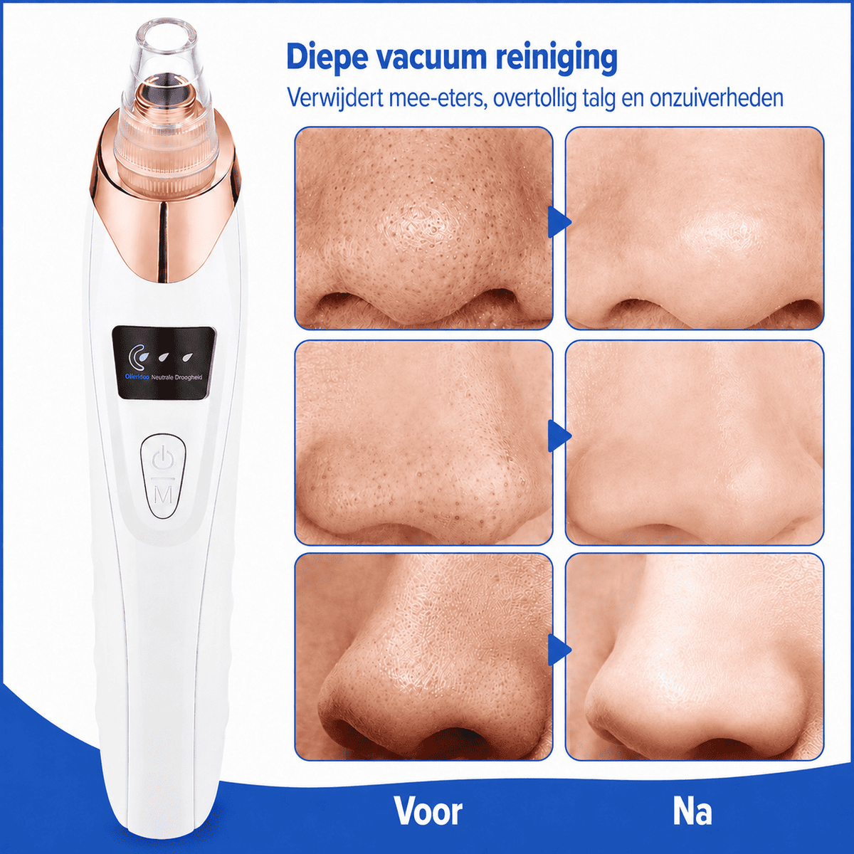 ClearPore™ | Voor een Gladdere, Schonere en Verzorgde Uitstraling.