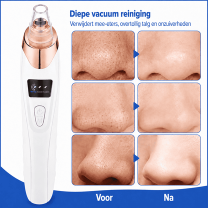 ClearPore™ | Voor een Gladdere, Schonere en Verzorgde Uitstraling.